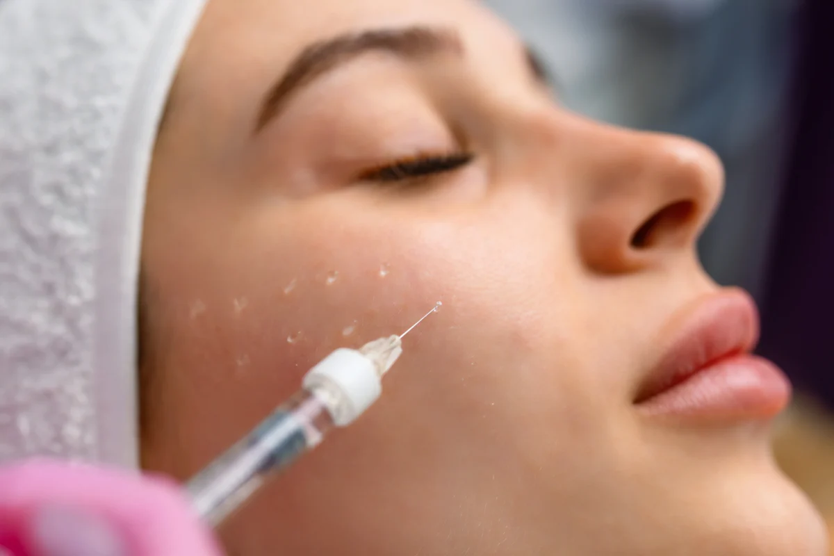 Close-up of a woman's face receiving a salmon DNA injection treatment to rejuvenate and hydrate skin for a youthful glow.