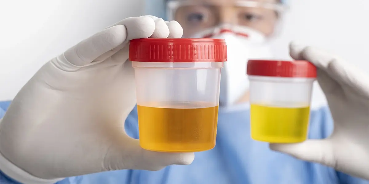blood-in-urine.webp