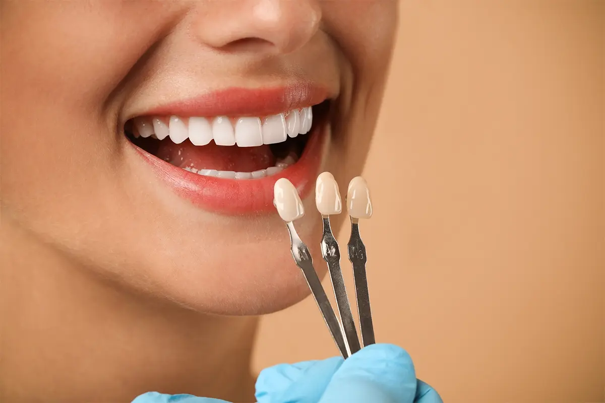Dentist comparing porcelain veneer shades with a patient in Abu Dhabi